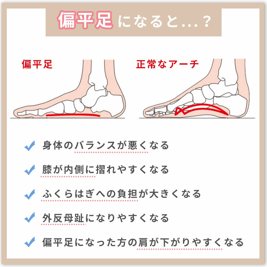 シリコンアーチサポーターZCA-ARCHS